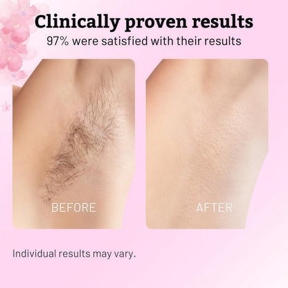 Caramela Beauty Cyperus Rotundus Oil for Natural Hair Reduction, 60ml After-Shave and Post-Wax Moisturizer with Jojoba, Rosehip and Sweet Almond Oils for Silky Smooth Skin, All Skin Types